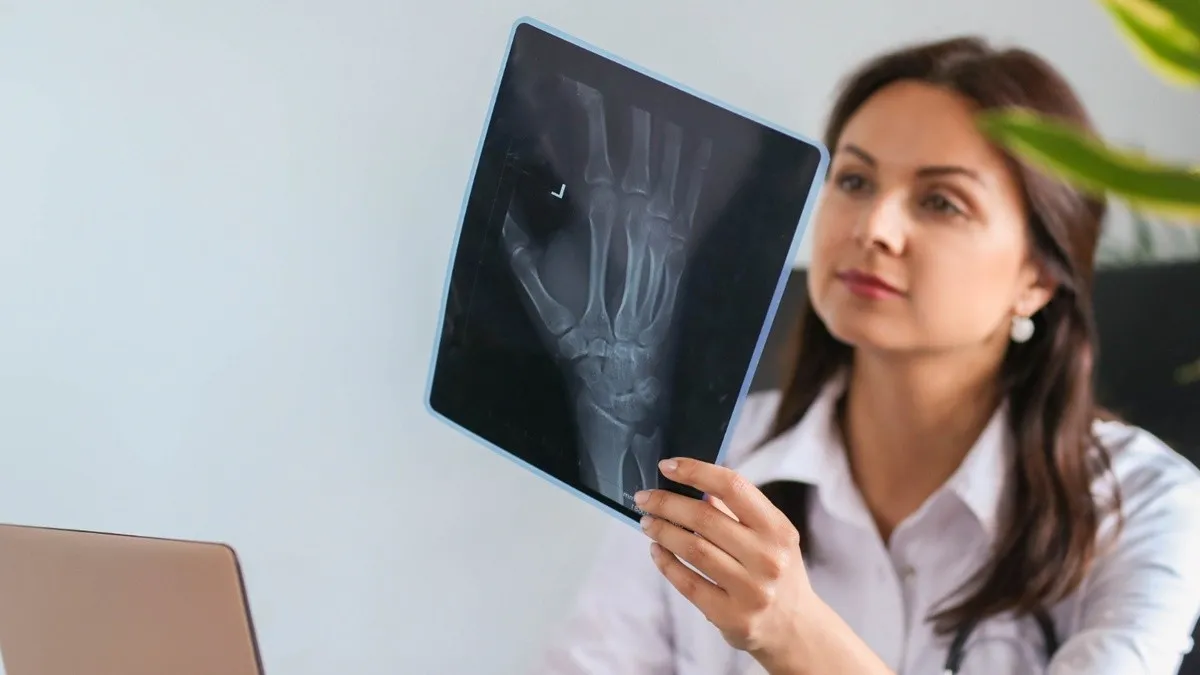 Una de cada tres mexicanas sufre osteoporosis y la mayoría no lo sabe