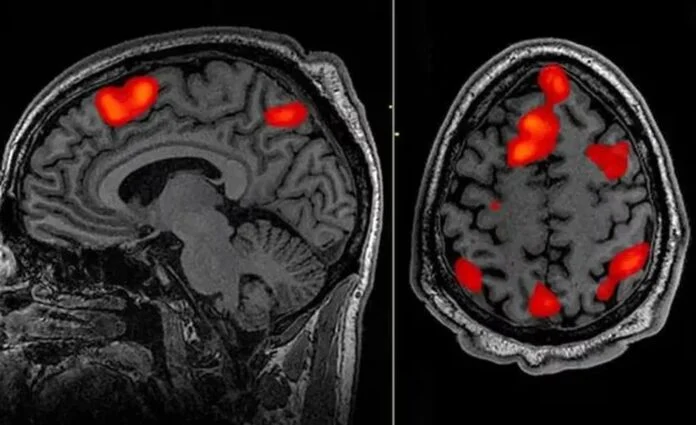 Inteligencia Artificial: el GPT logró leer el pensamiento de las personas y traducirlo en palabras