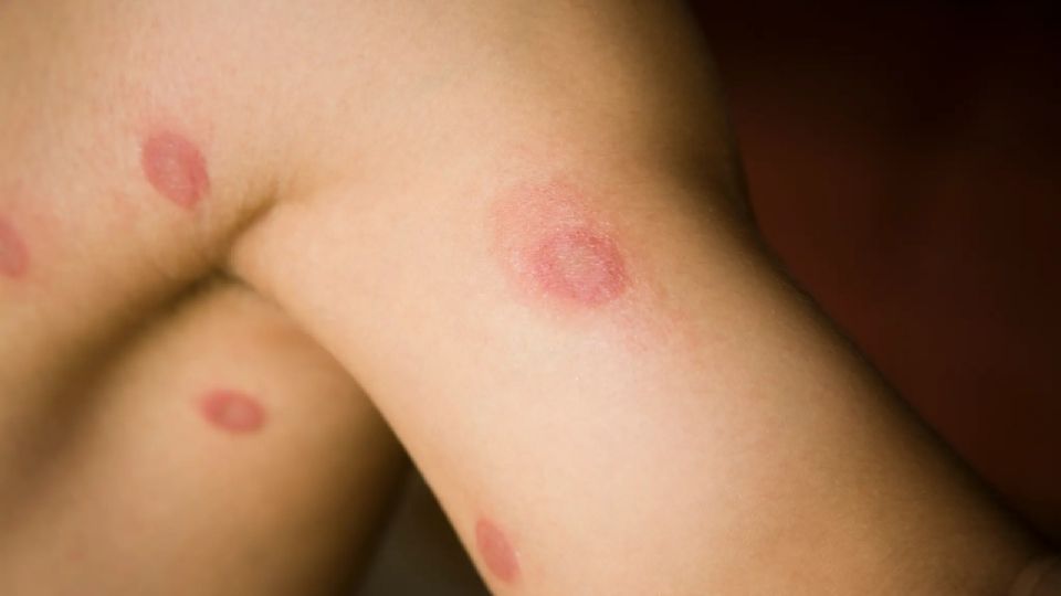 Nueva alerta epidemiológica en EU: detectan peligrosa cepa de hongos resistente a los medicamentos