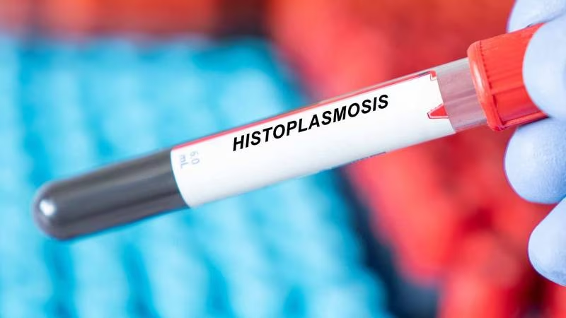 Histoplasmosis, el hongo que se propagó en cenotes de Yucatán: ¿Qué es y cuáles son sus riesgos?