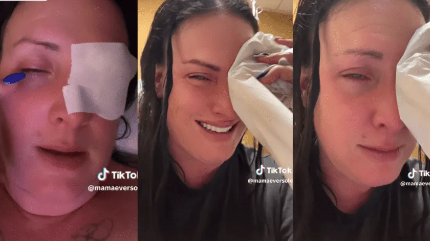 Video: Mujer confunde gotas para los ojos con pegamento para uñas