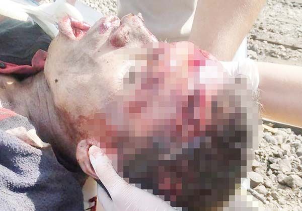 Aseguran fue por caída la muerte de migrante