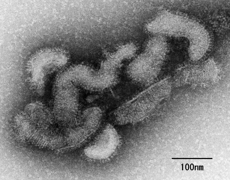 Virus Oz provoca primera muerte en Japón: ¿Qué es, síntomas y cómo se contagia?