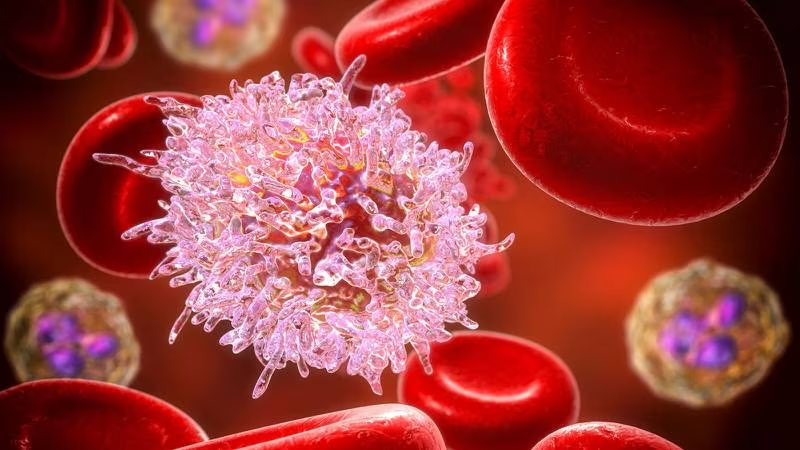 Leucemia mieloide: ¿Qué es y cuáles son las fases de la enfermedad que padecía Talina Fernández?
