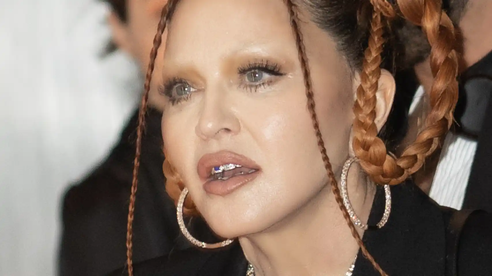 Habrían tenido que resucitar a Madonna previo a hospitalización