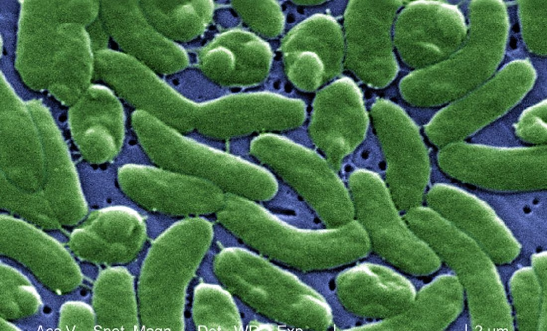 Bacteria mortal deja 3 muertos en EU. ¿Cuáles son sus síntomas?