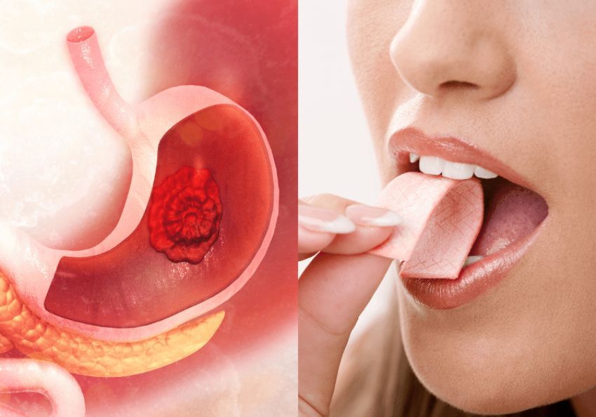 ¿Qué sucede cuando te tragas un chicle? Los expertos opinan