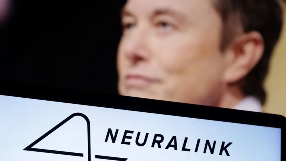 Neuralink recluta a pacientes para probar implantes cerebrales, ¿te interesa?