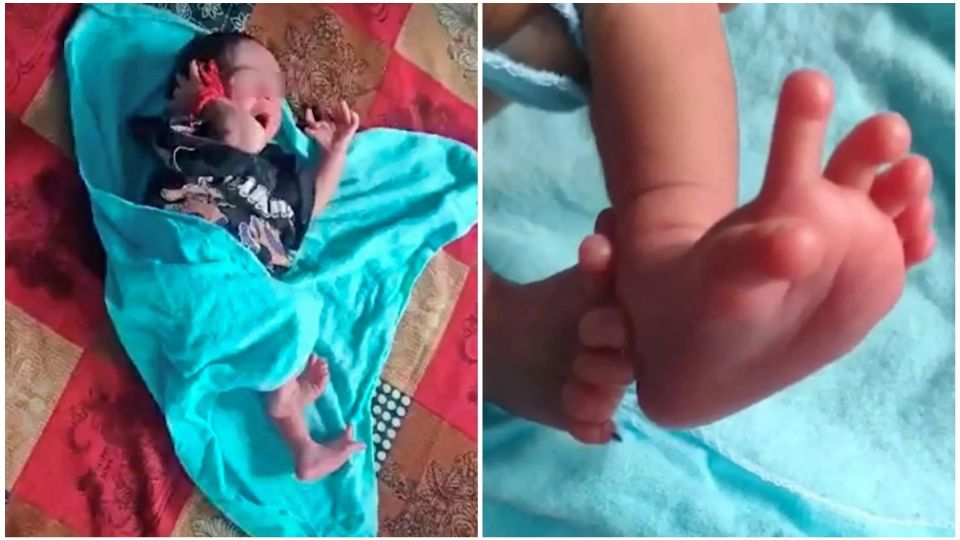 Una niña nació con 26 dedos y sus padres creen que es la reencarnación de una diosa