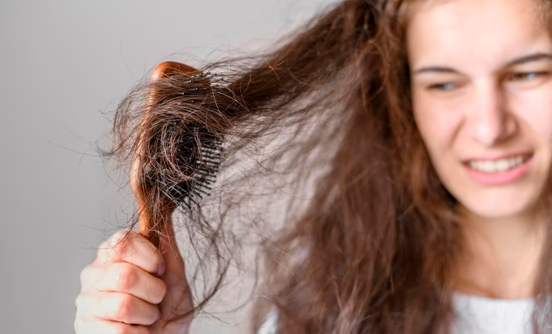  estos son los alimentos que aceleran la caída del cabello
