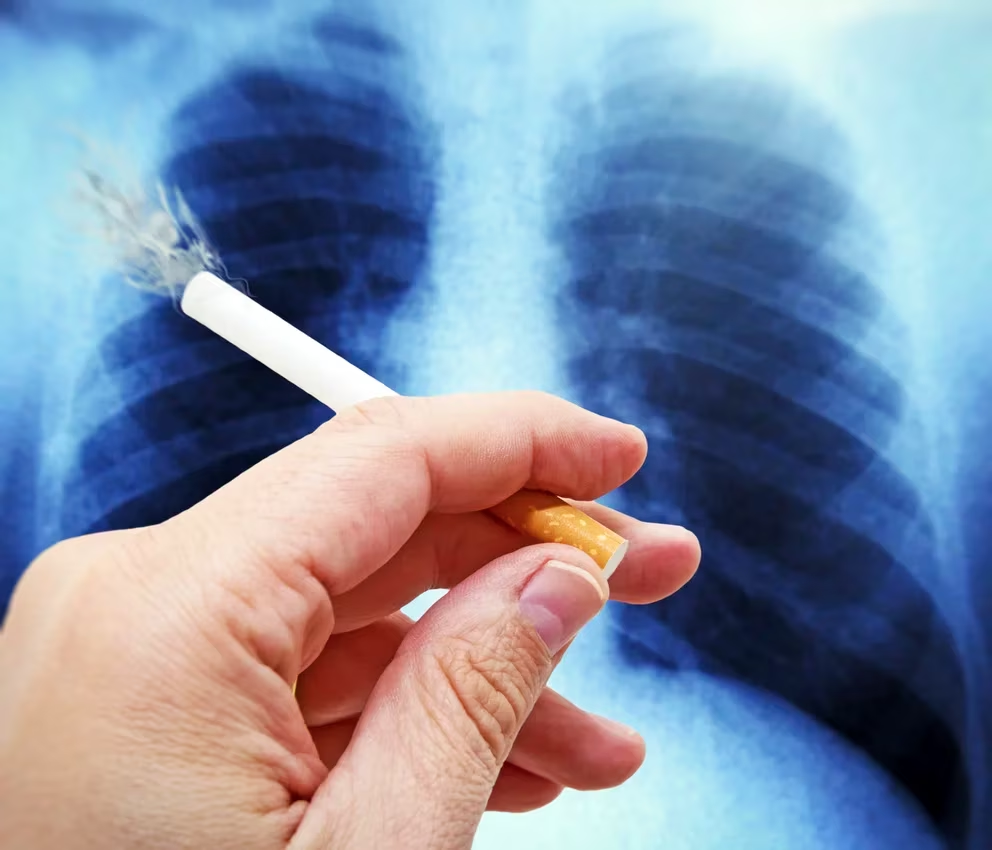 Epidemia del tabaco: qué cambió y qué está pendiente a 20 años de la firma del primer tratado mundial
