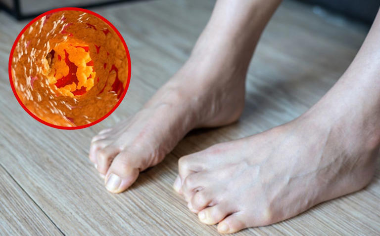 Calambres en los pies podrían ser a causa de estas enfermedades