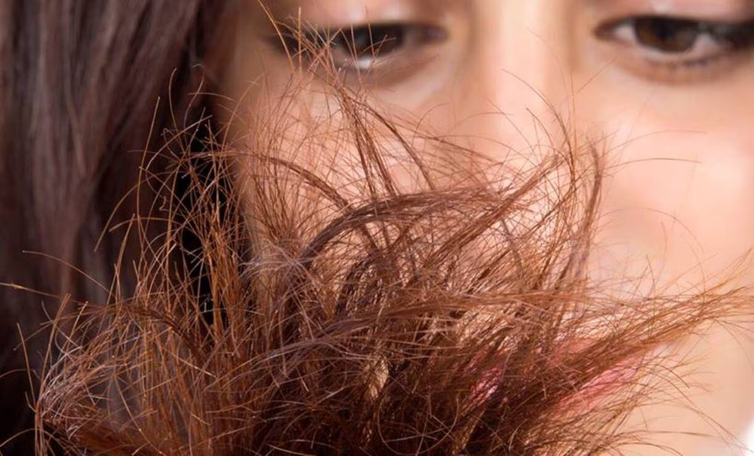 Hábitos diarios que causan orzuela en el cabello