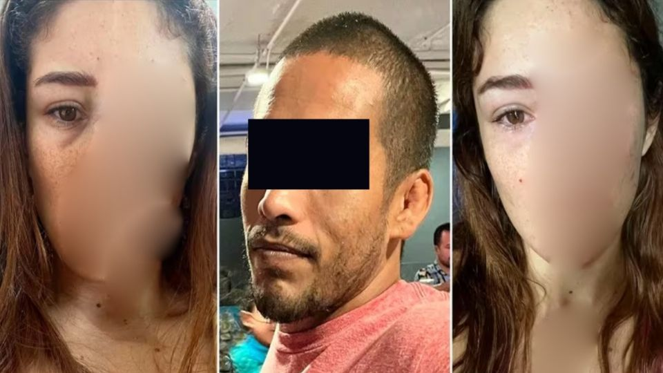 Luchadora mexicana expone agresión física y denuncia a su expareja por violencia familiar