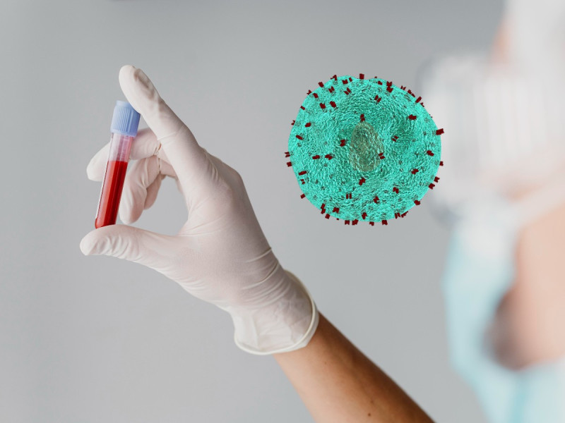 VIH y SIDA: diferencias, cómo se contagian y síntomas de estas enfermedades