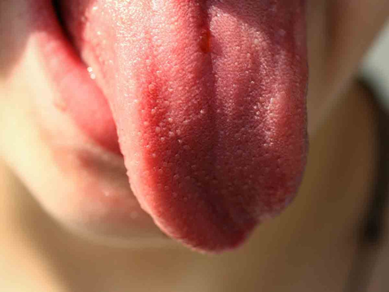 Mujer acude al dentista y le extirpan parte de la lengua al hallar un carcinoma