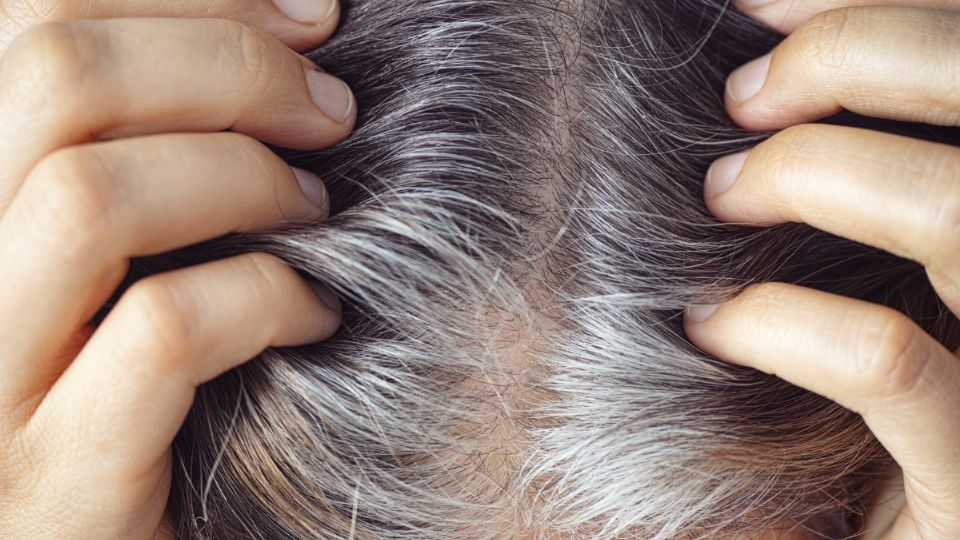 Despídete de las canas, con solo una fruta retrasa su aparición en tu cabello