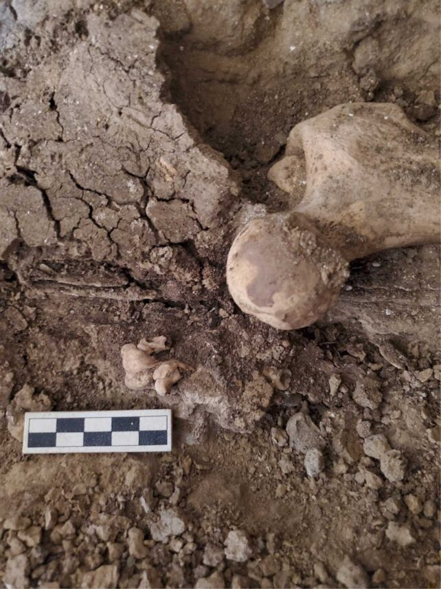 Científicos hallan un tumor con dientes en el antiguo Egipto que desafía a la medicina