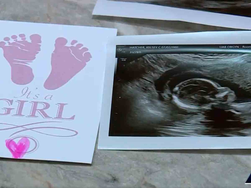 El extraño caso de una mujer con doble útero que quedó embarazada de ambos