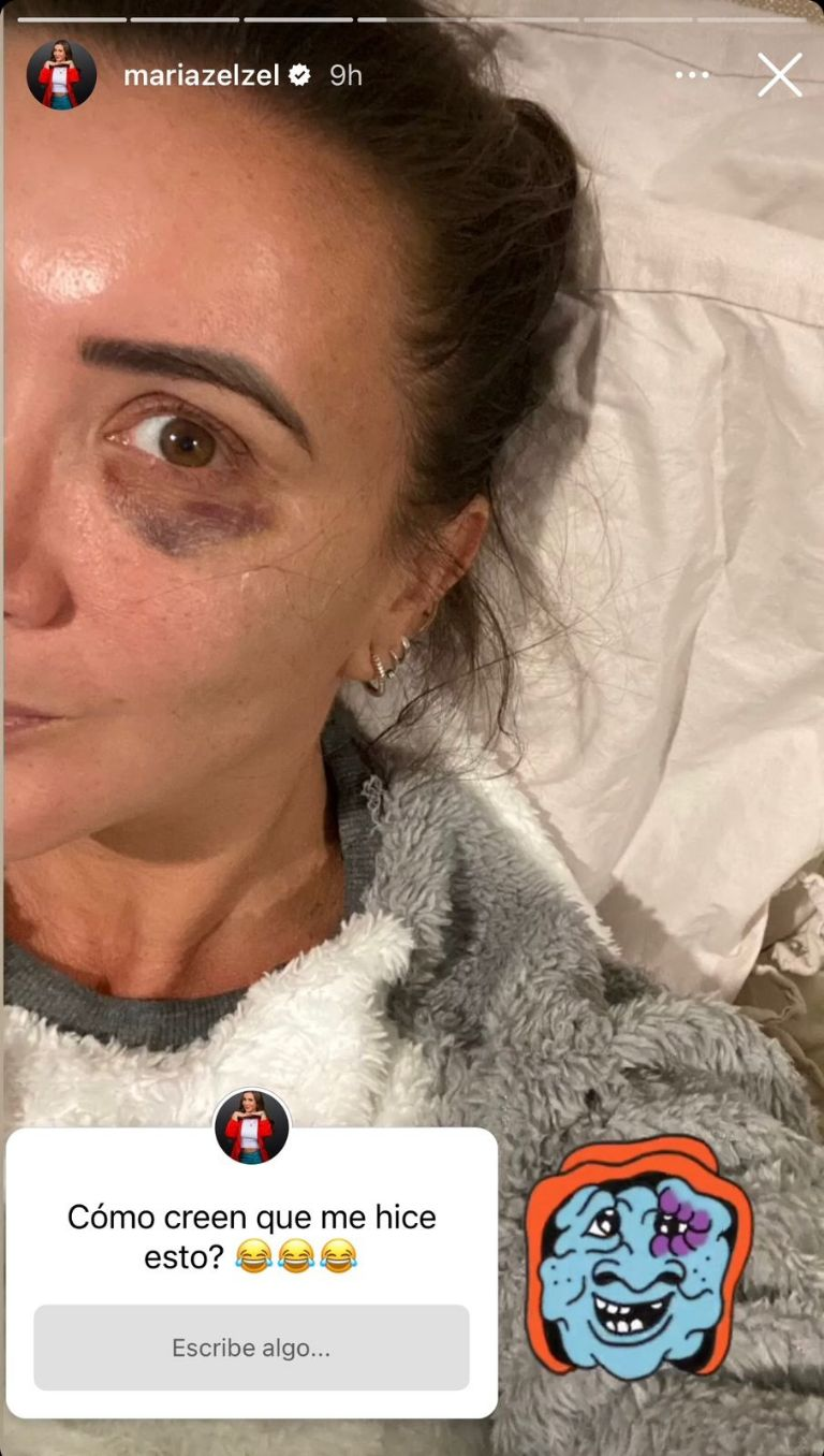 Mariazel preocupa a sus fans tras aparecer con el ojo morado y exhibe a su «agresor»: FOTO