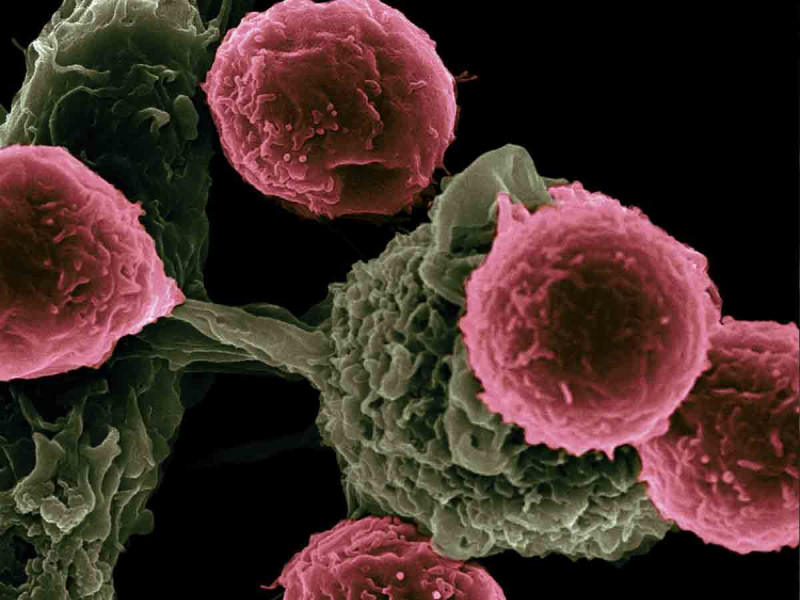 Innovador tratamiento contra el cáncer promete ser una ‘bomba de tiempo’ contra tumores