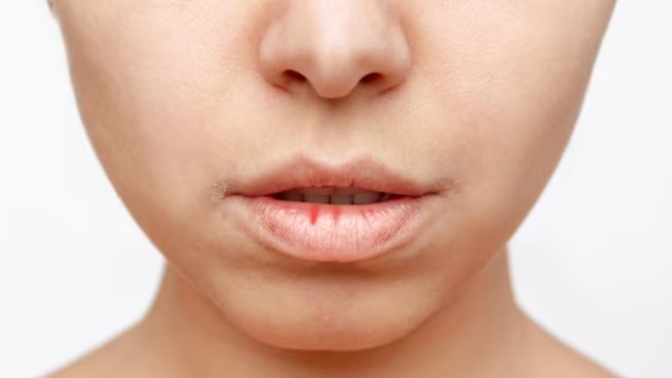 Labios partidos: así puedes crear un bálsamo casero súper efectivo contra el frío