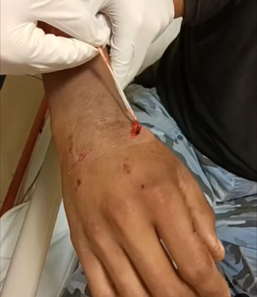 Desgarra pitbull mano a su dueño