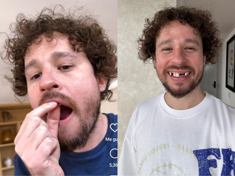 Luisito Comunica revela la razón por la que se le cayeron los dientes