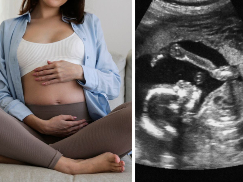 Cuáles son las enfermedades que transmite la madre al feto