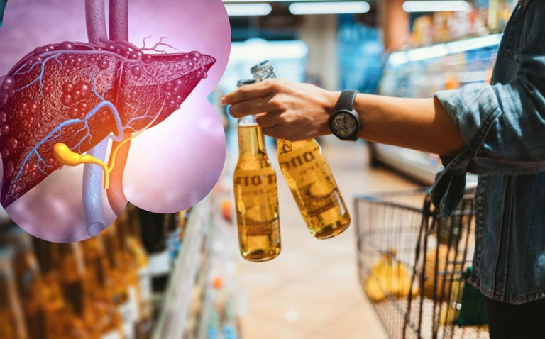 ¿Qué bebida alcohólica daña más el hígado?