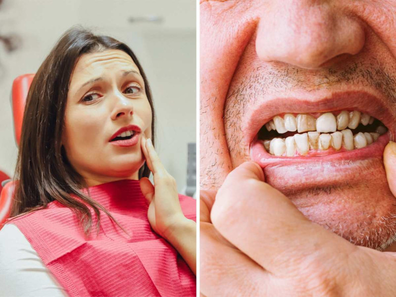 8 síntomas que te indican que podrías tener problemas en los dientes: podrían caerse