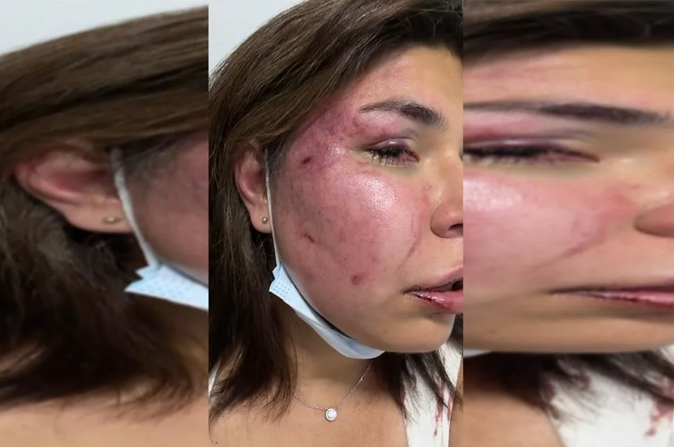 Mexicana denuncia intento de feminicidio en Colombia