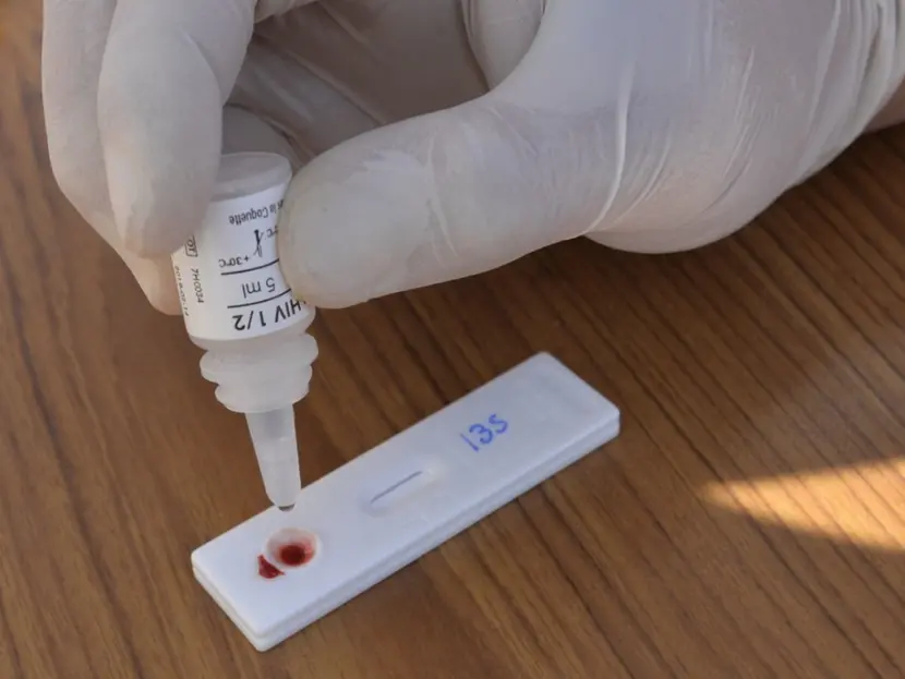 Cofepris autoriza autoprueba para la detección del VIH
