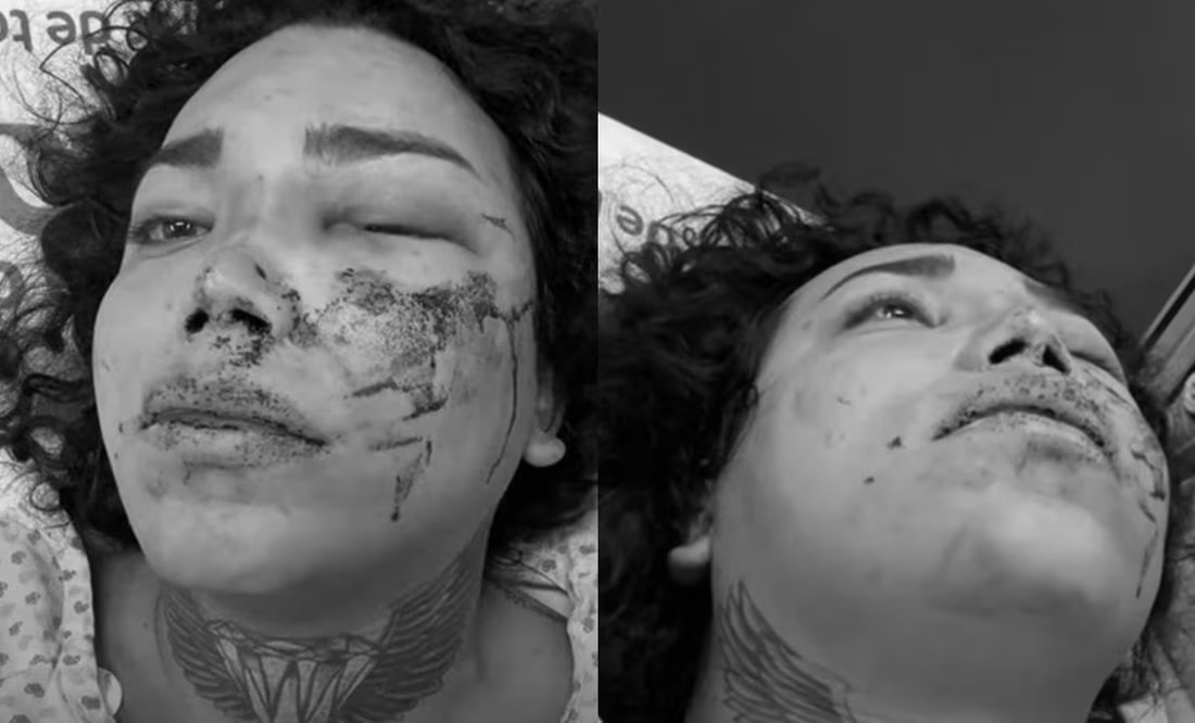 Paola Suárez de «Las Perdidas» anuncia demanda contra su prometido tras ser golpeada