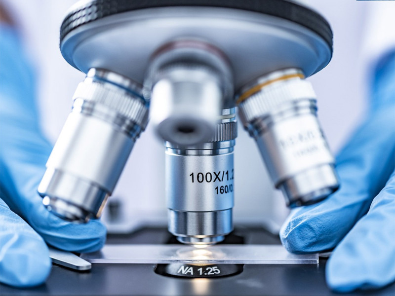 Descubren que virus de la hepatitis B y C son una de las causas del mieloma múltiple