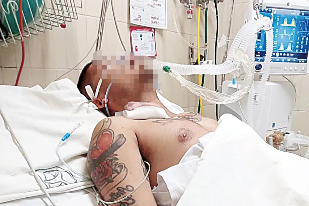 Se agrava su situación de detenido; muere hombre que atacó