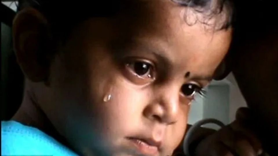 ¿Cómo tratar la migraña en niños? Conoce las causas de este dolor