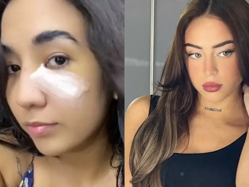 Fan de Nicki Nicole terminó en el hospital tras recibir botellazo de la cantante