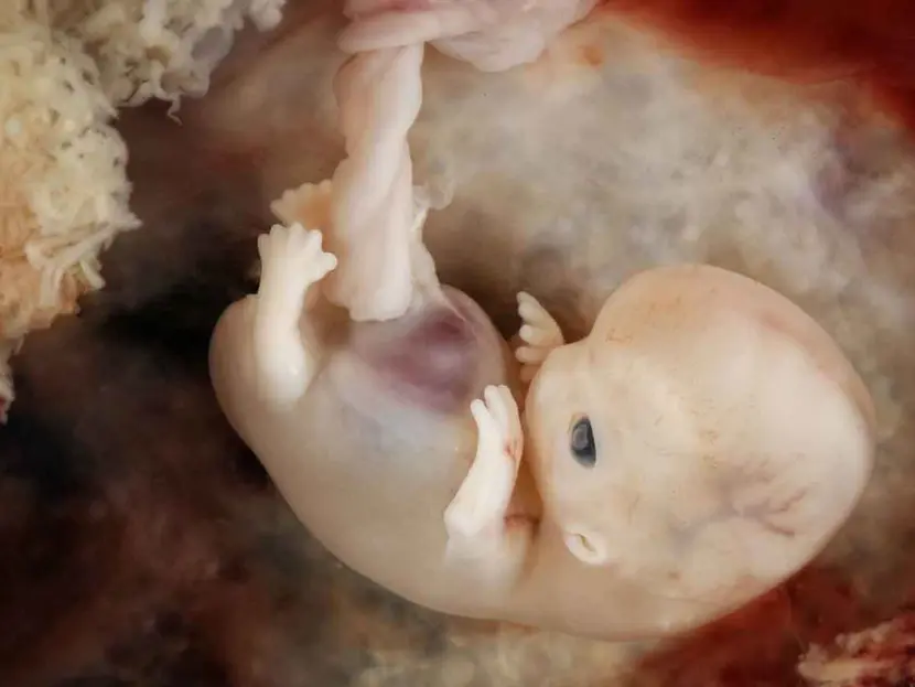 Hallan microplásticos potencialmente tóxicos en placentas humanas