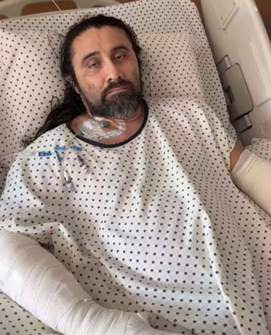 Atacan al comediante yucateco “Taco de Ojo”; le dieron 20 puñaladas