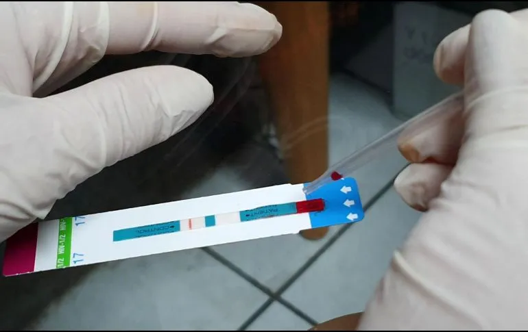 Científicos logran eliminar el VIH de células infectadas