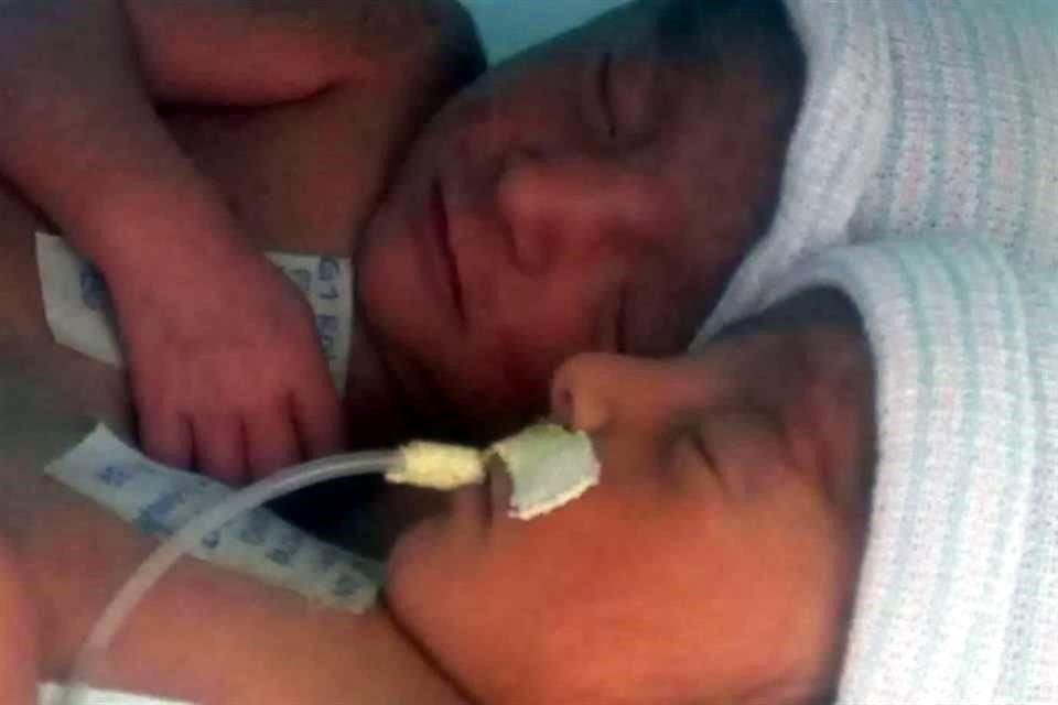 Separan con éxito a siamesas saltillenses