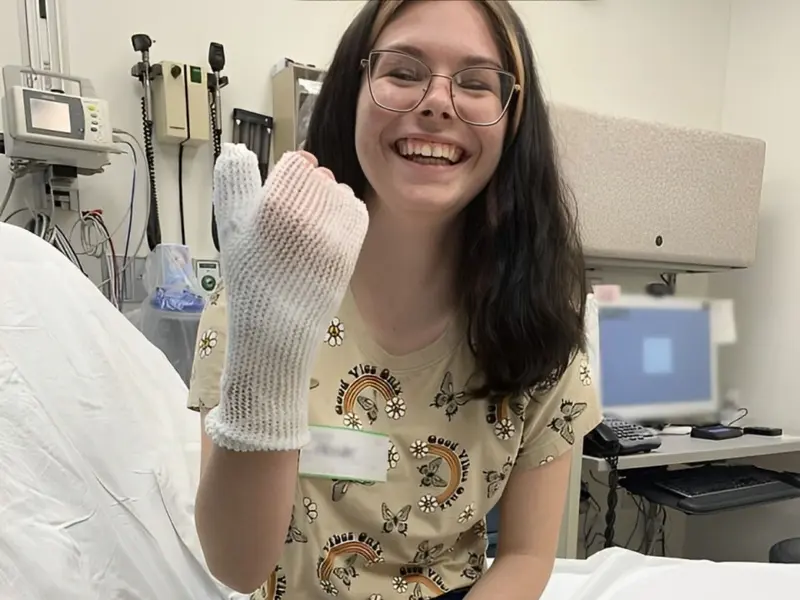 Joven sufre quemaduras graves tras depilarse la mano con receta viral de TikTok