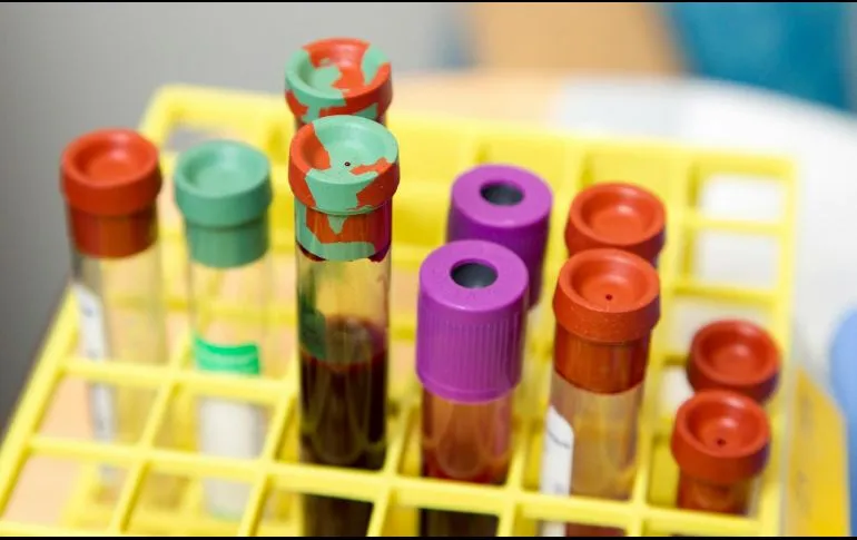 ¿Qué se puede beber antes de un análisis de sangre?