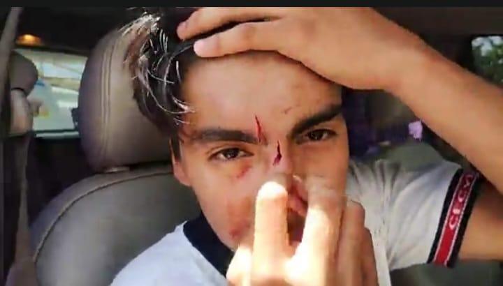 Agreden a estudiante tres encapuchados