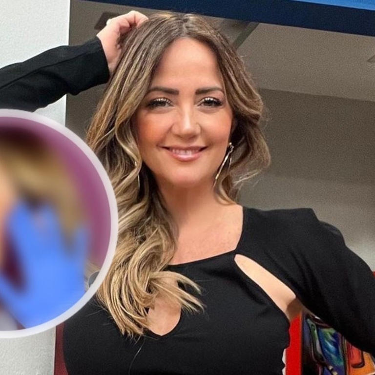 Andrea Legarreta se somete a procedimiento estético para lucir joven; así luce