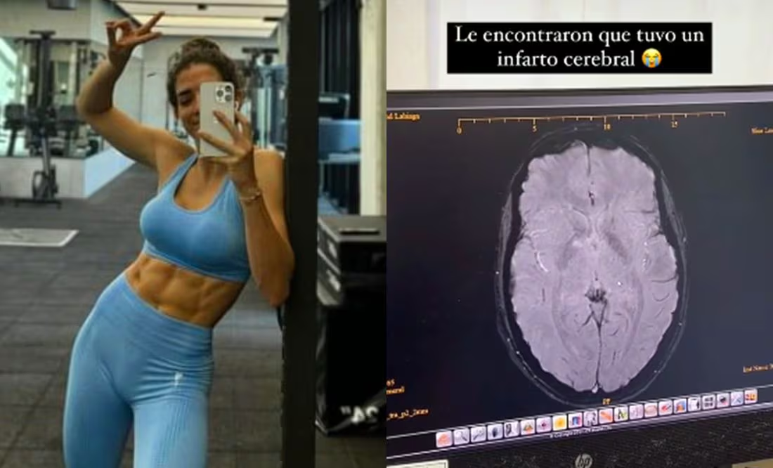 Influencer mexicana sufre infarto cerebral tras aplicación de botox en Dubái; “mis ojos estaban en blanco”