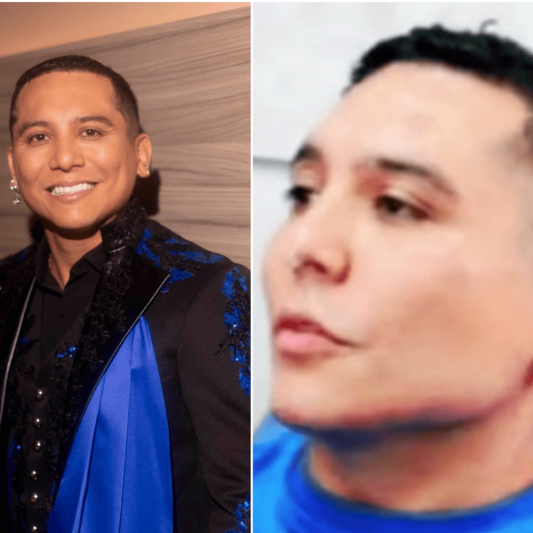 Edwin Luna ahora tiene un rostro femenino de acuerdo con cirujano estético