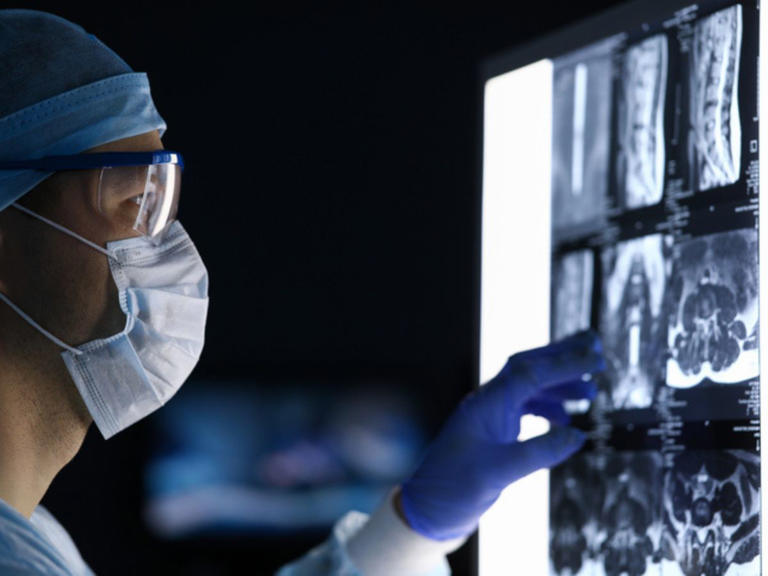 ¿Cuánto tiempo tarda un tumor en hacer metástasis?