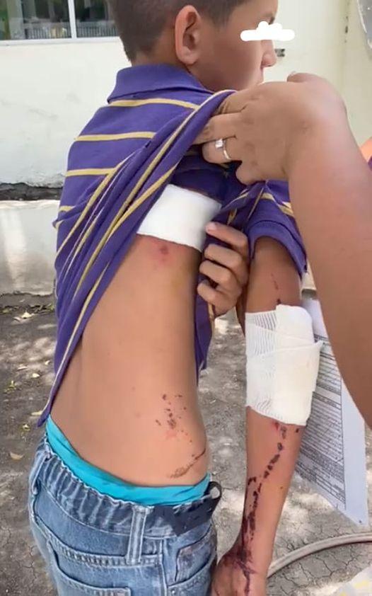 Sufren padre e hijo accidente carretero